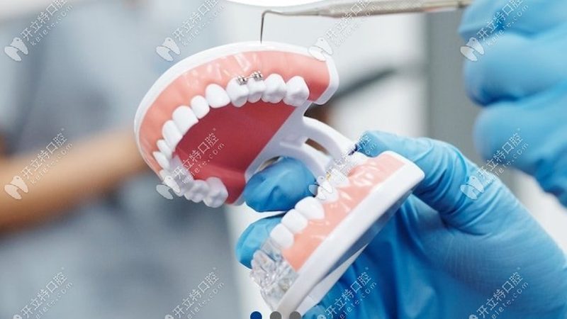 洗牙价格，如何看透“猫腻”？深圳牙科诊所洗牙价格对比解析**